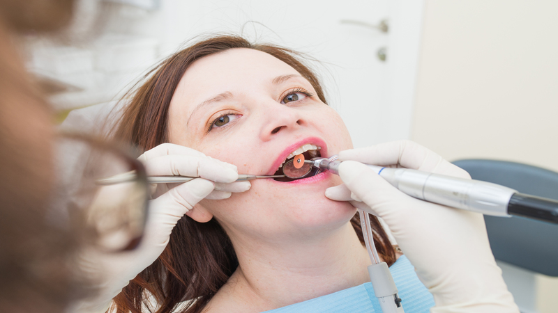 Get A Picture-Perfect Smile With Porcelain Veneers Treatment in St. Peters, MO